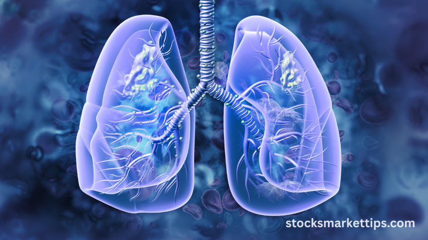 Lung conditions New AI test set to transform diagnosis